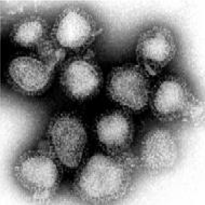 Le virus de la grippe (la taille d'une particule virale est voisine de 100 nm)