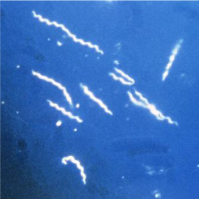 Une bactérie du genre Borella (la longueur de ces bactéries spiralées est de l'ordre de 20 µm)