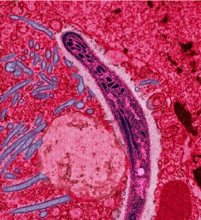 Plasmodium falciparum