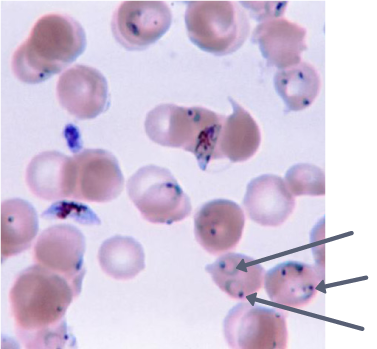 Plasmodium (anneaux pointés par les flèches) parasitant des hématies humaines