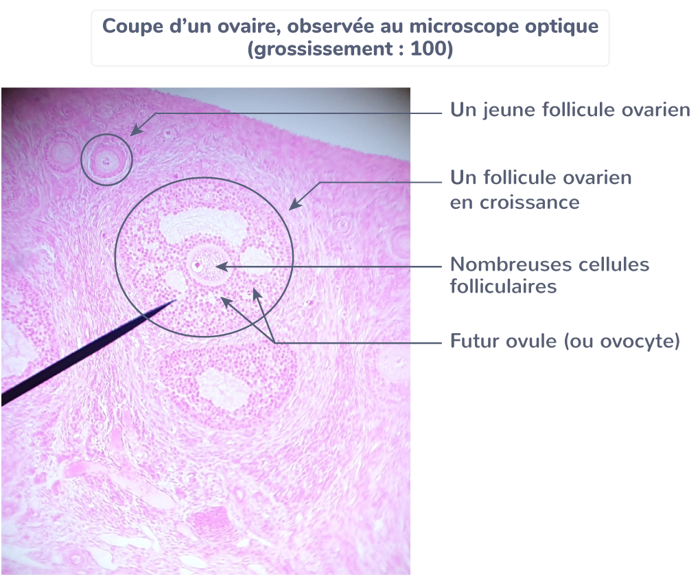 Immature Des Ovocytes Ovocytes Immatures La Ponction Causes Et 